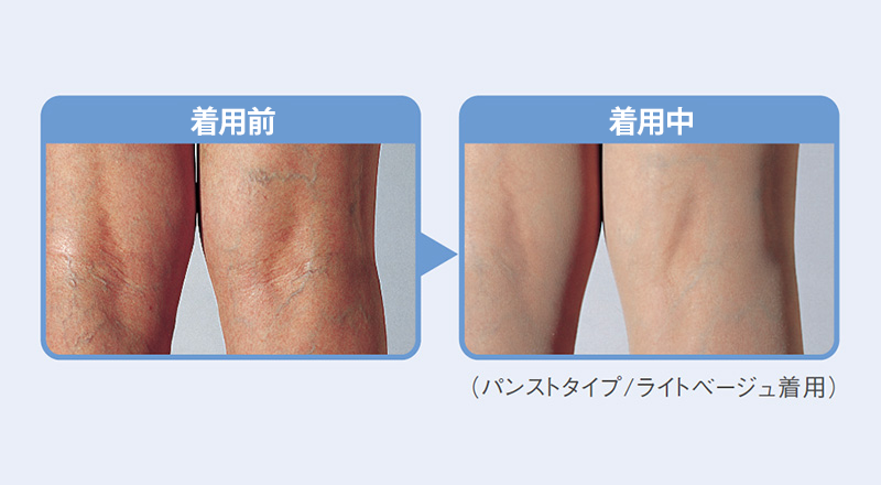 着用前後イメージ